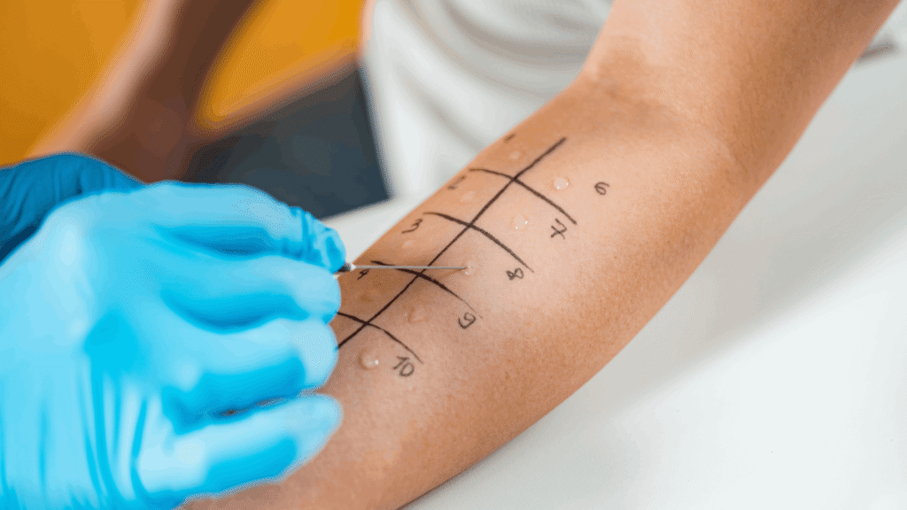 Allergy Testing
