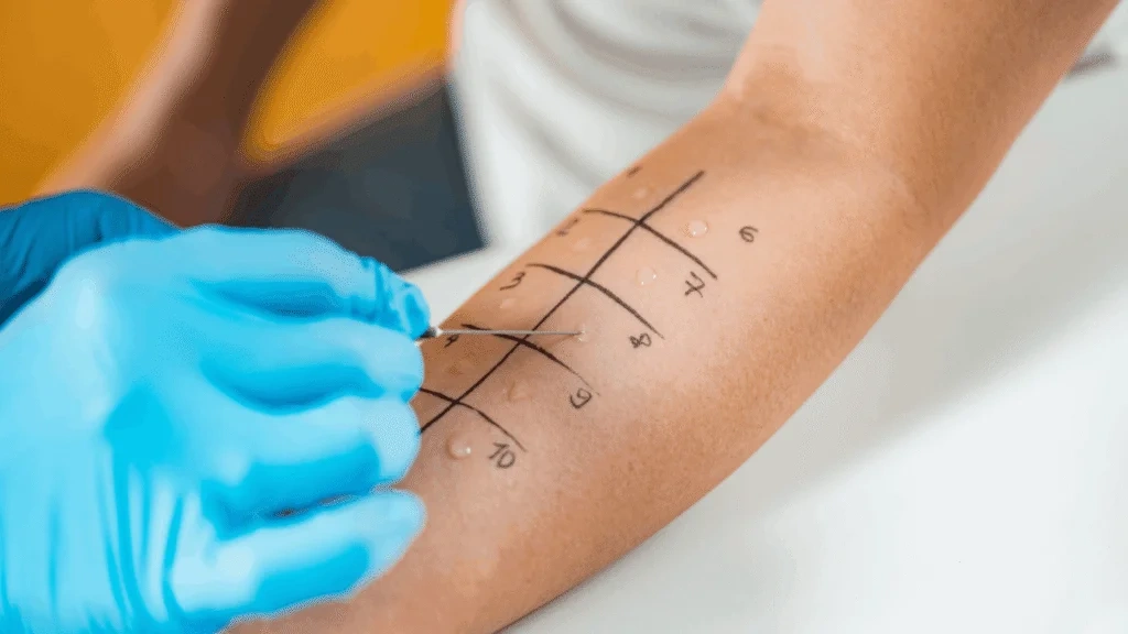 Allergy-Testing service