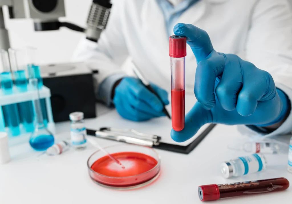 Most Common Blood Tests Explained

